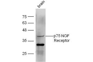 Mouse brain lysates probed with Anti-p75 NGF Receptor Polyclonal Antibody  at 1:5000 90min in 37˚C. (NGFR Antikörper  (AA 301-400))