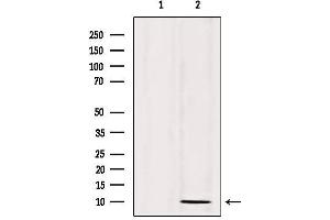 Western blot analysis of extracts from 293, using SPINK1 Antibody.