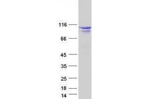 Western Blotting (WB) image for Oculocerebrorenal Syndrome of Lowe (OCRL) (Transcript Variant B) protein (Myc-DYKDDDDK Tag) (ABIN2727866)