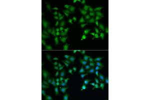 Immunofluorescence analysis of A549 cells using FLOT2 antibody (ABIN5973960). (Flotillin 2 Antikörper)