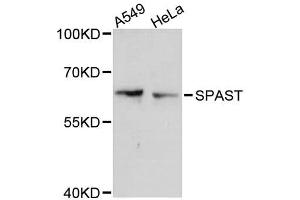 Western blot analysis of extracts of various cell lines, using SPAST antibody (ABIN5996162) at 1:3000 dilution. (Spastin Antikörper)