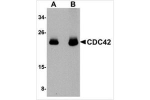 Western blot analysis of CDC42 in human brain tissue lysate with CDC42 antibody at (A) 0.