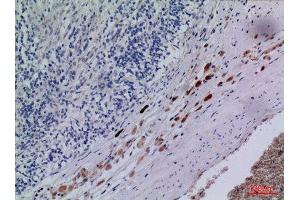 Immunohistochemistry (IHC) analysis of paraffin-embedded Human Brain, antibody was diluted at 1:100. (CXCR3 Antikörper  (Internal Region))