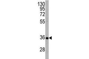 Western Blotting (WB) image for anti-ATG5 Autophagy Related 5 (ATG5) (AA 1-30) antibody (ABIN3030038)