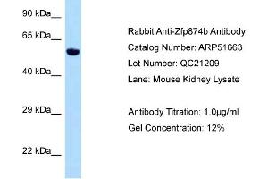 WB Suggested Anti-Zfp874b Antibody   Titration: 1. (Chitinase Antikörper  (Middle Region))