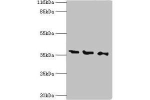 Western blot All lanes: N-acetyl-D-glucosamine kinase antibody at 2 μg/mL Lane 1: HepG2 whole cell lysate Lane 2: 293T whole cell lysate Lane 3: Hela whole cell lysate Secondary Goat polyclonal to rabbit IgG at 1/10000 dilution Predicted band size: 38, 43 kDa Observed band size: 38 kDa (NAGK Antikörper  (AA 2-344))