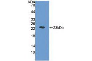 Western blot analysis of recombinant Human a1AGP. (ORM1 Antikörper  (AA 19-201))