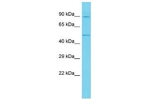 Host: Rabbit Target Name: ANKRD10 Sample Type: U937 Whole Cell lysates Antibody Dilution: 1. (ANKRD10 Antikörper  (C-Term))