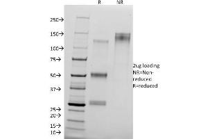 SDS-PAGE Analysis of Purified CTNND1 Mouse Monoclonal Antibody (25a). (CTNND1 Antikörper)