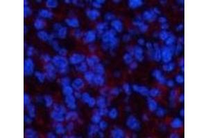 Immunofluorescence analysis of Mouse spleen tissue using PPARD Monoclonal Antibody at dilution of 1:200. (PPARD Antikörper)