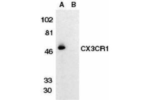 Western Blotting (WB) image for anti-Chemokine (C-X3-C Motif) Receptor 1 (CX3CR1) antibody (ABIN2473127)