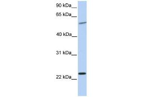 Synaptogyrin 2 antibody used at 1 ug/ml to detect target protein.