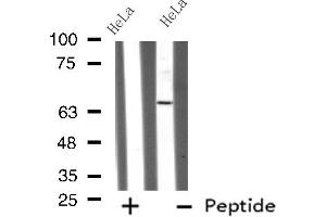 Western blot analysis GRK4 using HeLa whole cell lysates (GRK4 Antikörper  (N-Term))