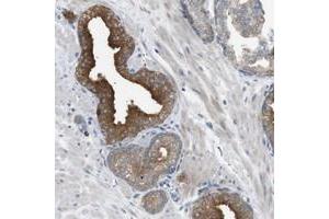 Immunohistochemical staining of human prostate with B4GALNT2 polyclonal antibody  shows strong cytoplasmic positivity in glandular cells.