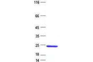 Validation with Western Blot (ST8SIA4 Protein (His tag))