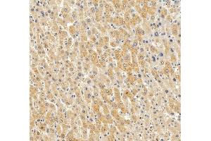 IHC analysis of PON1 using anti-PON1 antibody (ABIN7600530). (PON1 Antikörper  (AA 20-252))