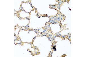 Immunohistochemistry of paraffin-embedded mouse lung using PIP antibody at dilution of 1:100 (40x lens). (PIP Antikörper)