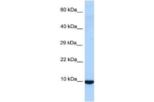 WB Suggested Anti-Id3 Antibody Titration: 1. (ID3 Antikörper  (Middle Region))