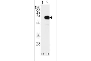 Western blot analysis of SD4 Antibody (arrow) using rabbit polyclonal SD4 Antibody  (ABIN392165 and ABIN2841882). (SMAD4 Antikörper  (AA 255-284))