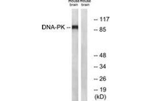 Western Blotting (WB) image for anti-Dynamin 1 (DNM1) (AA 740-789) antibody (ABIN2888626) (Dynamin 1 Antikörper  (AA 740-789))