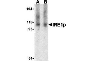 Western Blotting (WB) image for anti-Endoplasmic Reticulum To Nucleus Signaling 1 (ERN1) (Middle Region) antibody (ABIN1030962) (ERN1 Antikörper  (Middle Region))