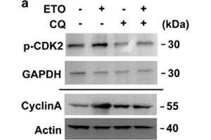 Western Blotting (WB) image for anti-Glyceraldehyde-3-Phosphate Dehydrogenase (GAPDH) antibody (ABIN2857072)