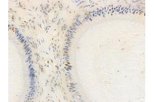 ABIN7093211 and ABIN7097222 at 1/100 staining human testicular cancer by IHC-P.