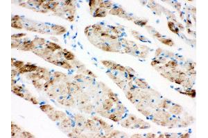 Anti- CPT1B Picoband antibody, IHC(P) IHC(P): Rat Cardiac Muscle Tissue