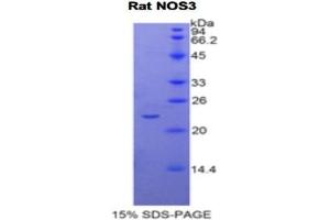 SDS-PAGE analysis of Rat NOS3 Protein. (ENOS Protein)