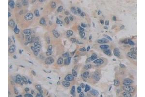 Immunohistochemistry (IHC) image for anti-H2A Histone Family, Member Y (H2AFY) (AA 109-369) antibody (ABIN7439753)