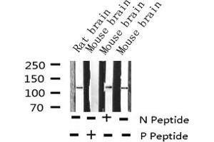 Western blot analysis of Phospho-Retinoblastoma (Ser807) expression in various lysates (Retinoblastoma 1 Antikörper  (pSer807))