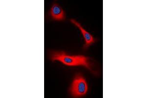 Immunofluorescent analysis of LT beta staining in HeLa cells. (LTB Antikörper  (C-Term))