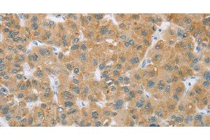 Immunohistochemistry (Paraffin-embedded Sections) (IHC (p)) image for anti-Cytochrome P450, Family 2, Subfamily C, Polypeptide 9 (CYP2C9) antibody (ABIN7000592)