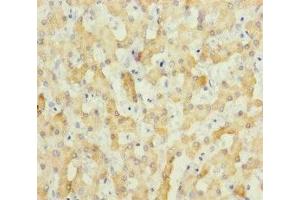 Immunohistochemistry of paraffin-embedded human liver tissue using ABIN7151803 at dilution of 1:100 (ECHS1 Antikörper  (AA 28-290))