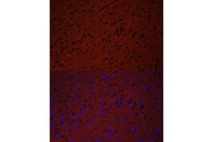 Immunofluorescence analysis of rat brain using STXBP1 antibody (ABIN6128255, ABIN6148673, ABIN6148674 and ABIN6221073) at dilution of 1:50. (STXBP1 Antikörper  (AA 295-594))