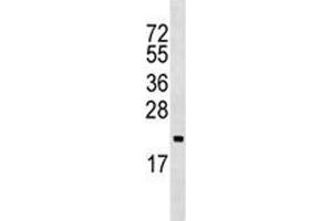 ARF5 antibody western blot analysis in Ramos lysate