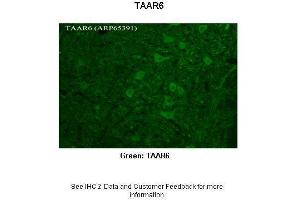 Researcher: Timur Mavlyutov, Ph. (TAAR6 Antikörper  (C-Term))