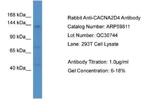WB Suggested Anti-CACNA2D4  Antibody Titration: 0. (CACNA2D4 Antikörper  (C-Term))