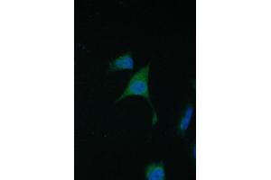 IF analysis of TIMM17A using anti-TIMM17A antibody (ABIN6719637). (TIMM17A Antikörper)