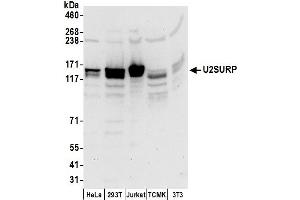 anti-U2-Associated SR140 Protein (SR140) (AA 1-50) antibody