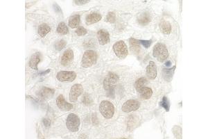 Immunohistochemistry (IHC) image for anti-Forkhead Box P1 (FOXP1) (AA 627-677) antibody (ABIN7448572) (FOXP1 Antikörper  (AA 627-677))