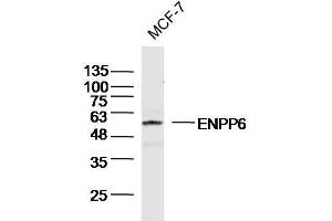 MCF-7 Cell lysates probed with ENPP6 Polyclonal Antibody, unconjugated (bs-13076R) at 1:300 overnight at 4°C followed by a conjugated secondary antibody for 60 minutes at 37°C. (ENPP6 Antikörper  (AA 251-350))