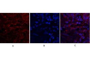 Immunofluorescence analysis of human lung tissue. (CXCL12 Antikörper  (C-Term))