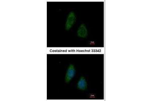 ICC/IF Image Immunofluorescence analysis of methanol-fixed HeLa, using BMP4, antibody at 1:200 dilution. (BMP4 Antikörper  (C-Term))