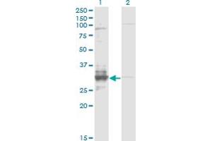 Western Blot analysis of TFPI2 expression in transfected 293T cell line by TFPI2 monoclonal antibody (M01), clone 3E8. (TFPI2 Antikörper  (AA 1-235))