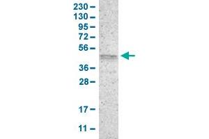 Western Blot analysis of human cell line RT-4 with PRKX polyclonal antibody . (PRKX Antikörper  (AA 267-342))