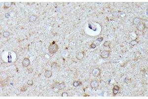 Immunohistochemistry of paraffin-embedded Rat brain using N-WASP Polyclonal Antibody at dilution of 1:100 (40x lens). (Neural Wiskott-Aldrich syndrome protein (WASL) Antikörper)