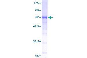 RPRD1B Protein (AA 1-326) (GST tag)