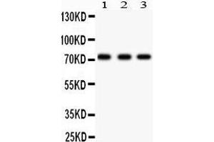 Anti- p73 antibody, Western blotting All lanes: Anti p73  at 0. (Tumor Protein p73 Antikörper  (AA 1-198))