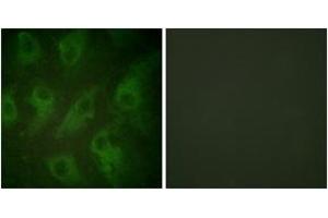 Immunofluorescence analysis of HeLa cells, using Kir6. (KCNJ11 Antikörper  (AA 190-239))